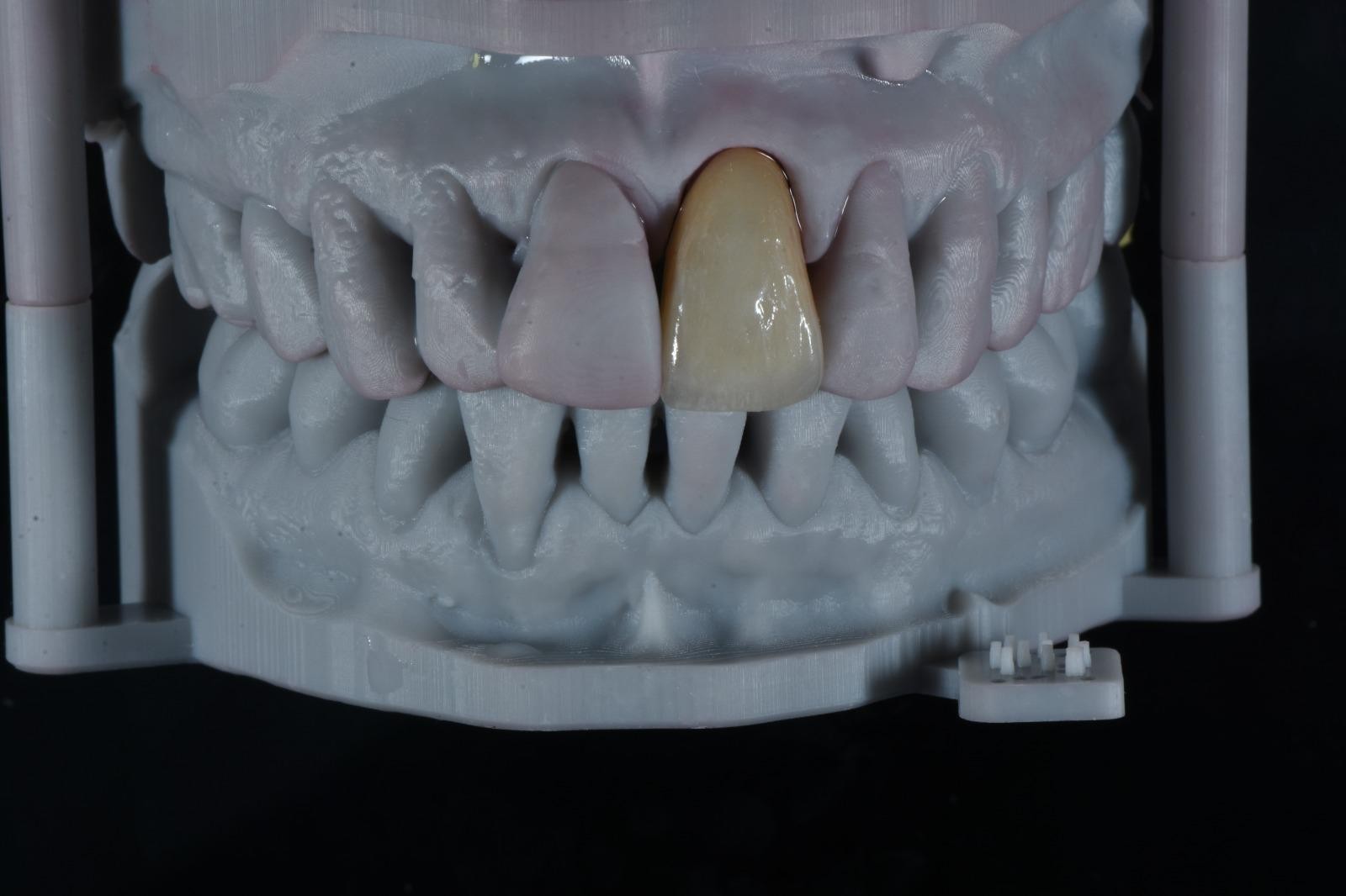 OBSIDIAN DENTAL LAB