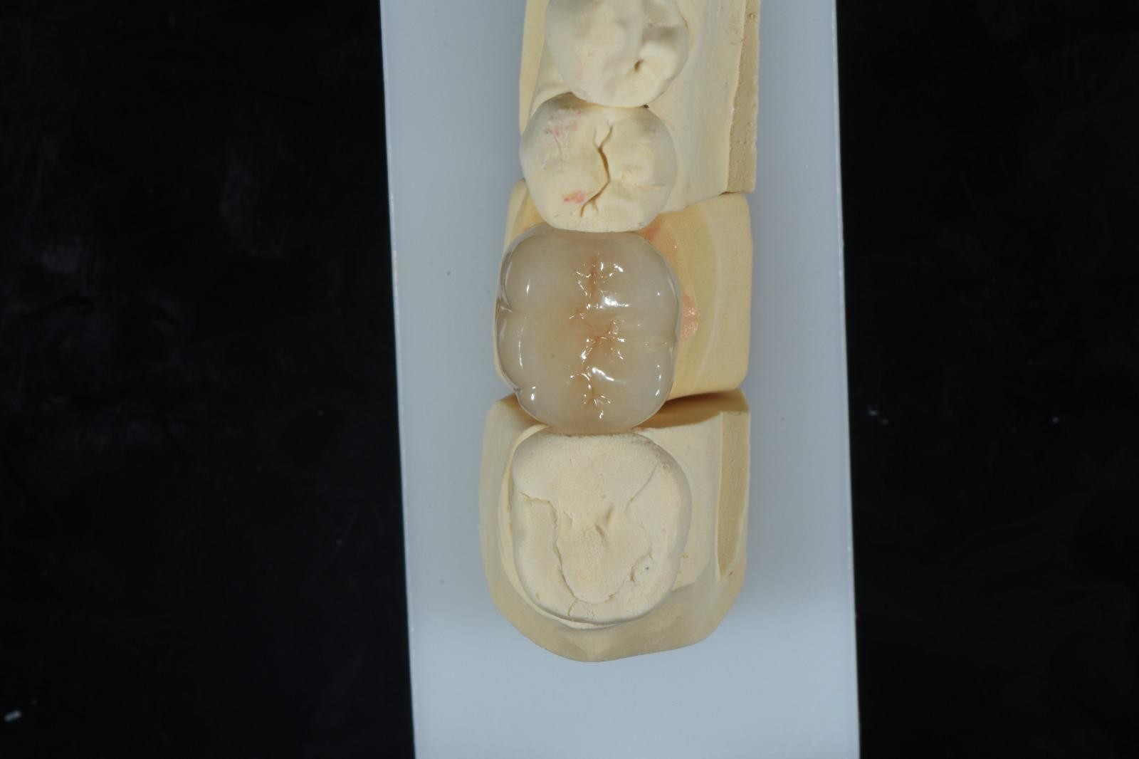 OBSIDIAN DENTAL LAB