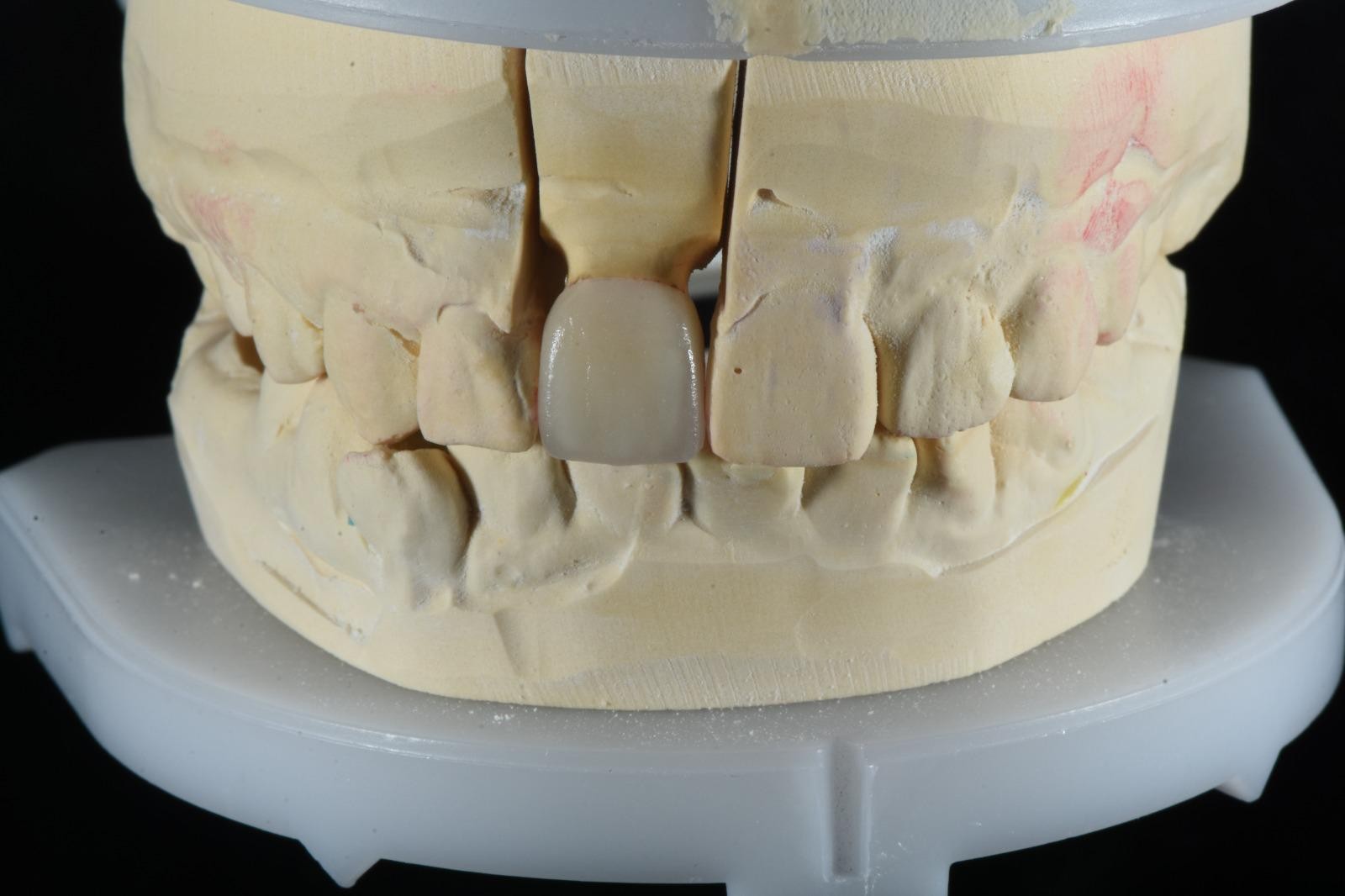 OBSIDIAN DENTAL LAB