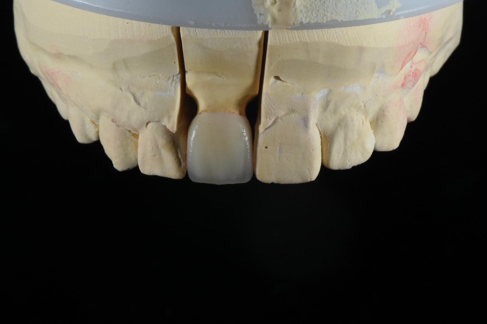 OBSIDIAN DENTAL LAB