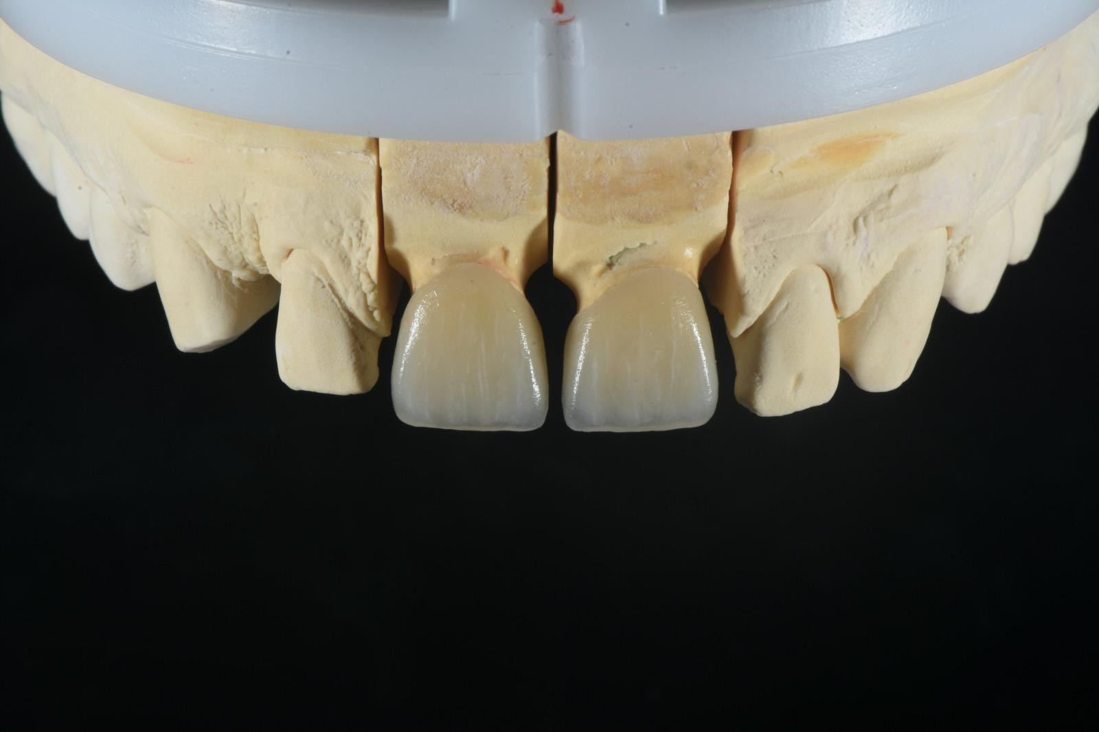 OBSIDIAN DENTAL LAB