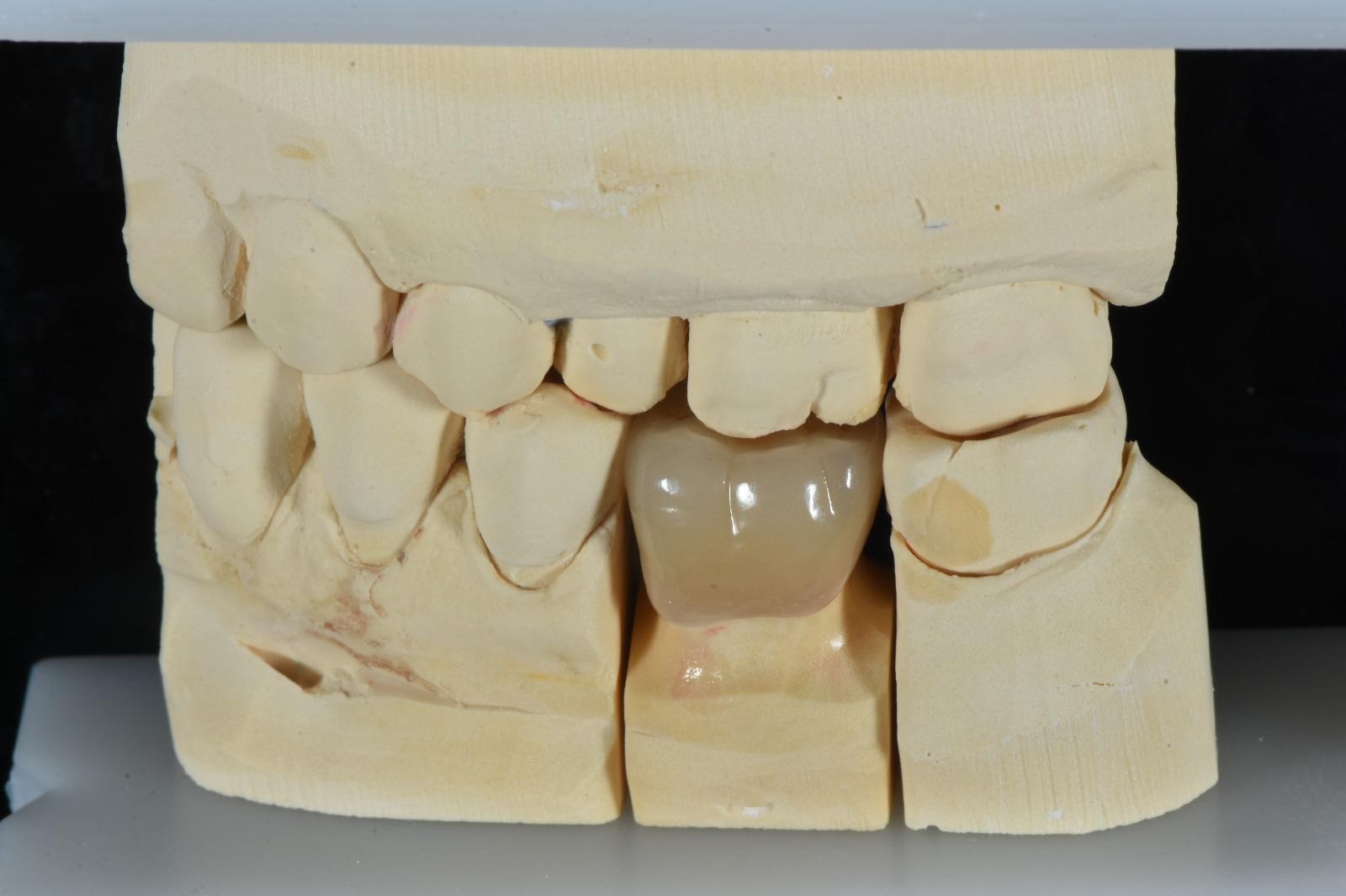 OBSIDIAN DENTAL LAB