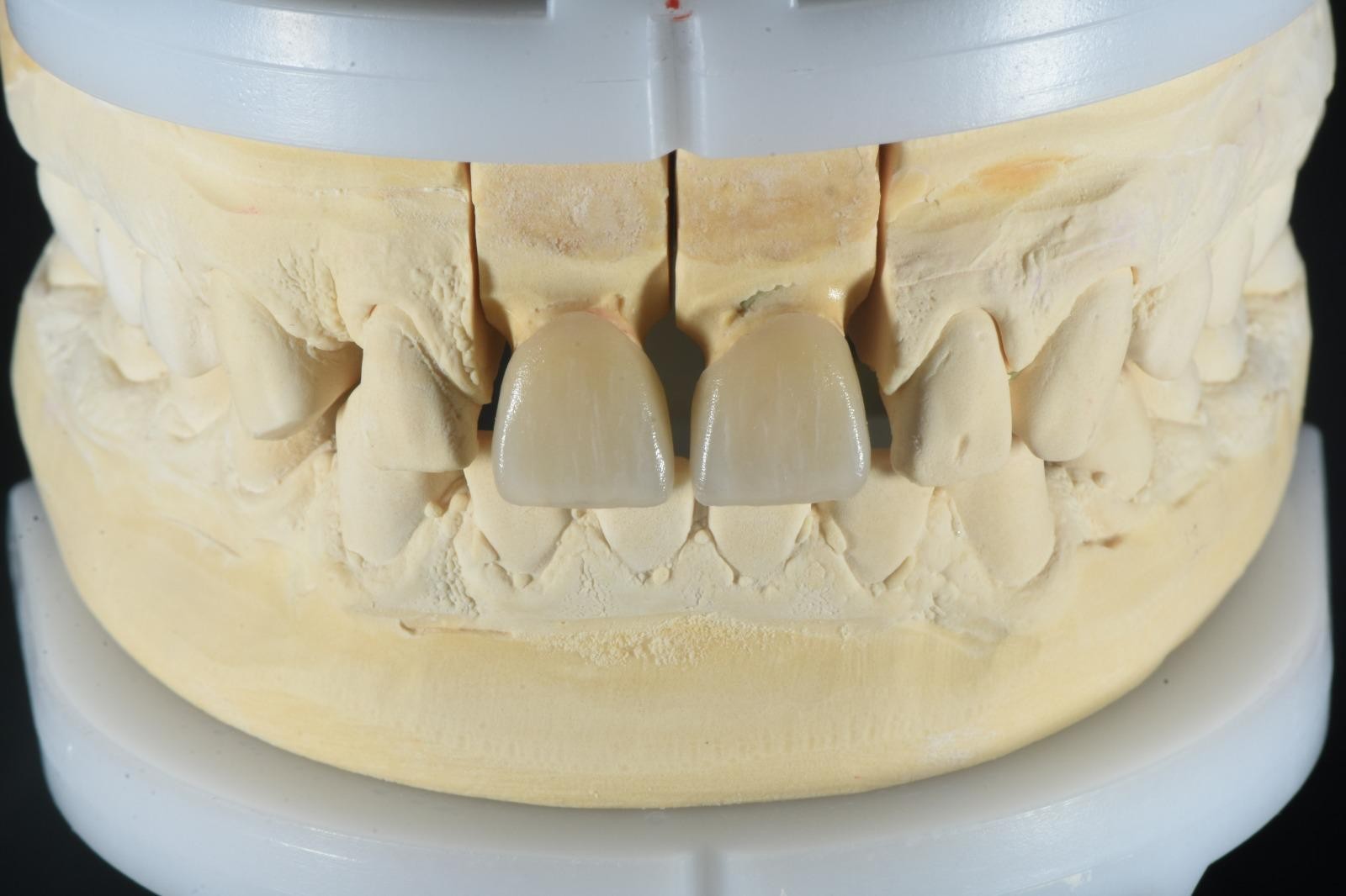OBSIDIAN DENTAL LAB