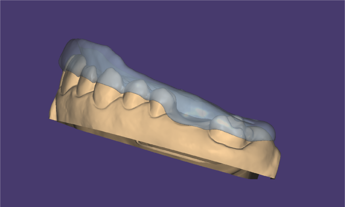 Digi'protheses