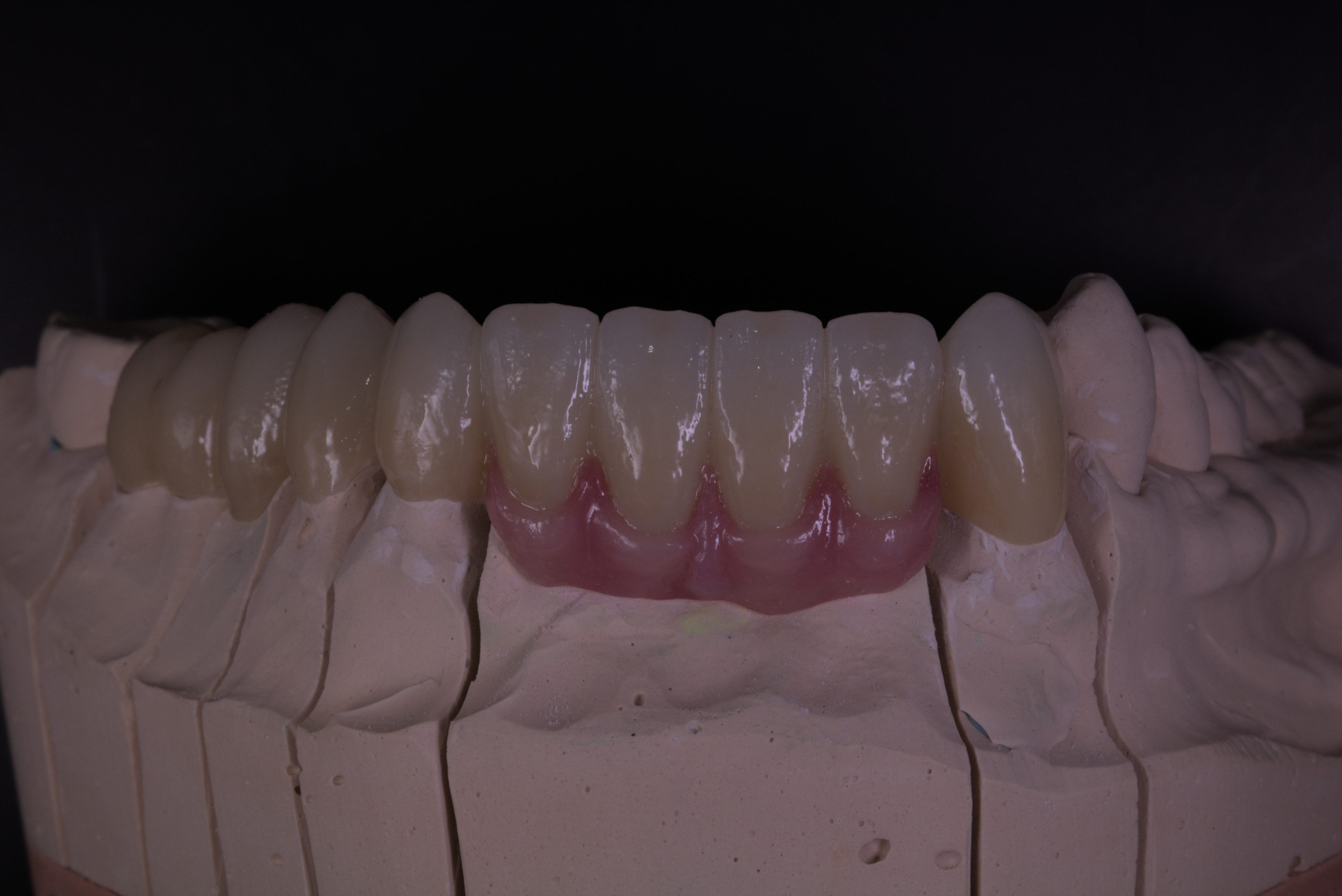 New Dental