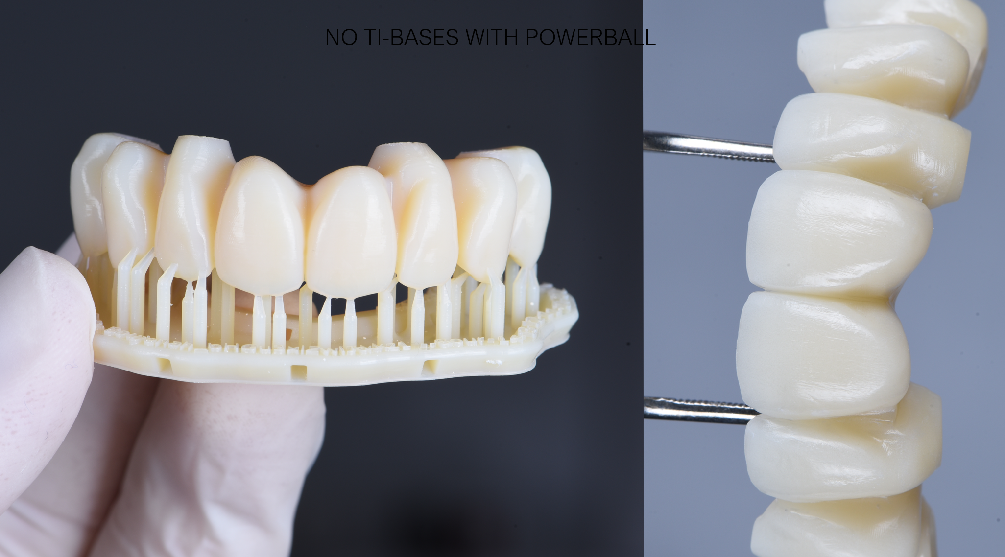 Impression 3D