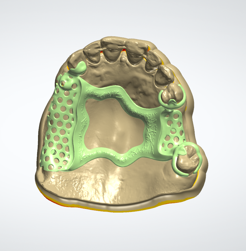 Dental Design