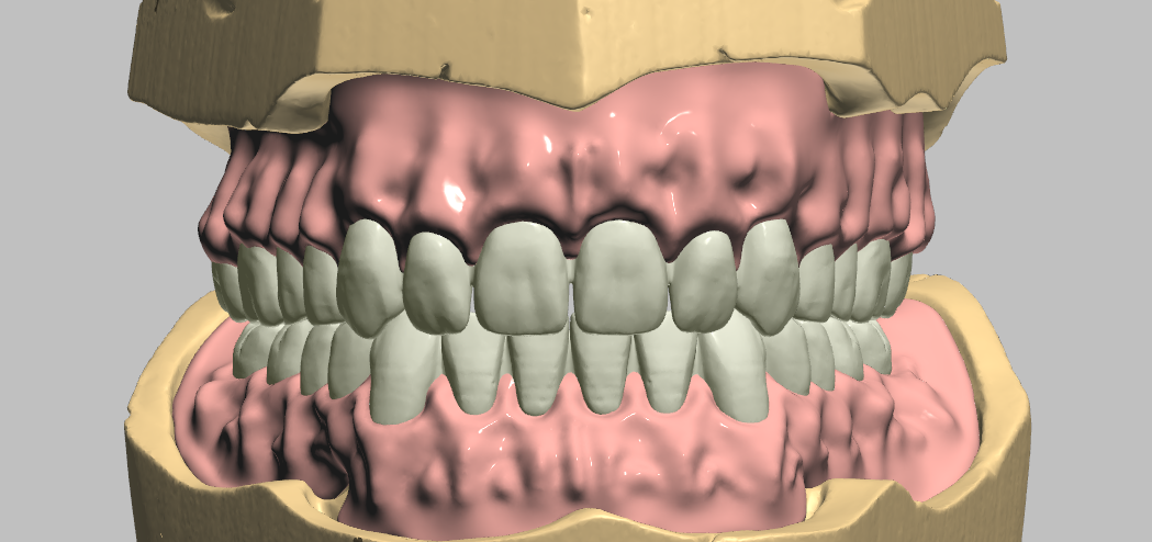 Dental Design